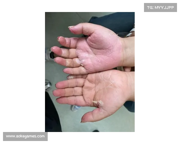 高优一郎团队回应击打质疑 通过腹部淤伤证明实力与决心